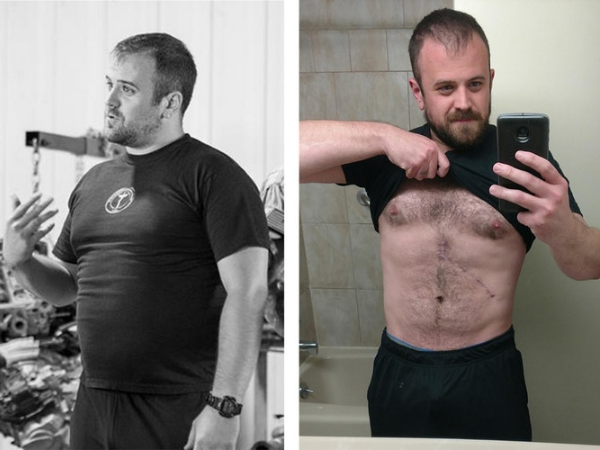 Phillip Meece Before & After