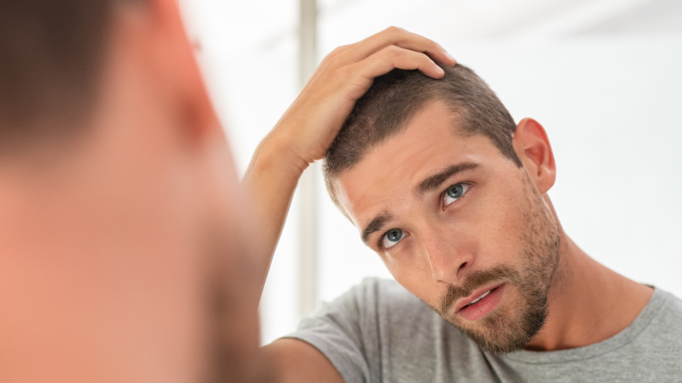 Male Balding: Is It More Than Just Genetics?