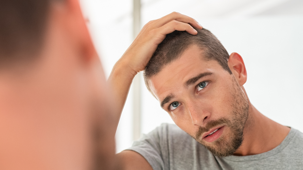 Male Balding: Is It More Than Just Genetics?
